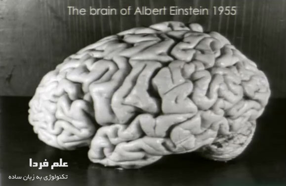 مغز انیشتین