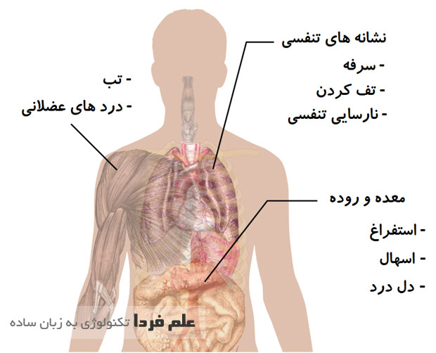 علایم بیماری مرس MERS - عکس از Wikipedia ، ترجمه علم فردا